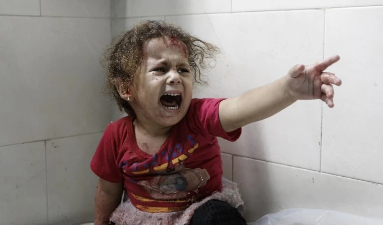 طفلة تبكي في مستشفى الشفاء بعد إصابتها في غارة على منزلها (أ ف ب) طفلة تبكي في مستشفى الشفاء بعد إصابتها في غارة على منزلها (أ ف ب)