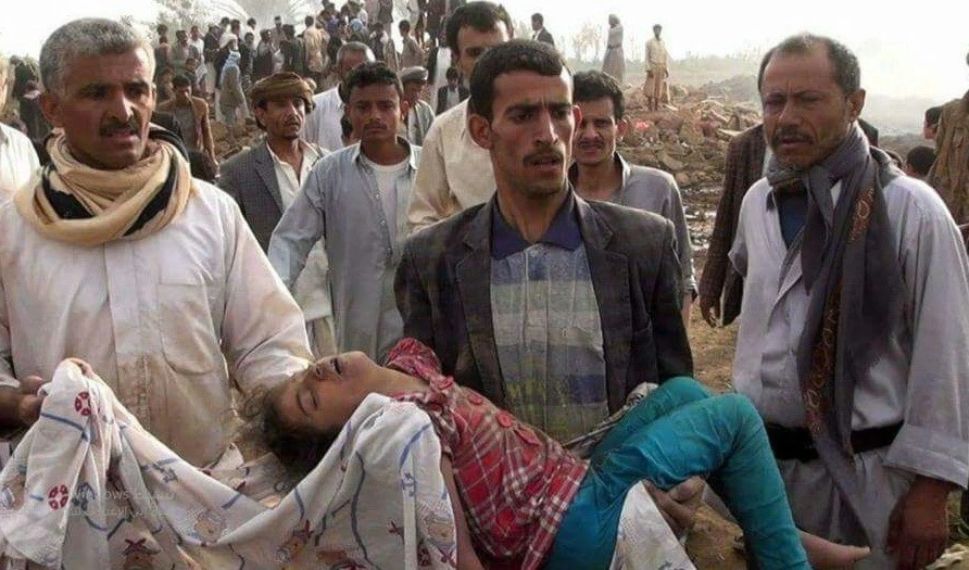 إحدى ضحايا مجزرة ارتبكها التحالف السعودي إحدى ضحايا مجزرة ارتبكها التحالف السعودي