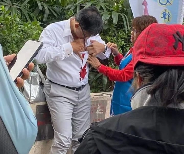 متظاهر في هونغ كونغ يطعن نائب في صدره متظاهر في هونغ كونغ يطعن نائب في صدره