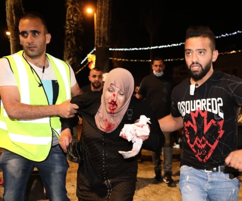 اعتداء قوات الاحتلال الإسرائيلي على سيدة مقدسية 8 أيار/مايو 2021 اعتداء قوات الاحتلال الإسرائيلي على سيدة مقدسية 8 أيار/مايو 2021